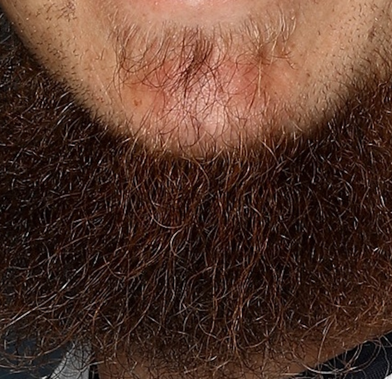 Illustration for article titled Wow! Look Upon Colby Rasmus's Beard, And Puke
